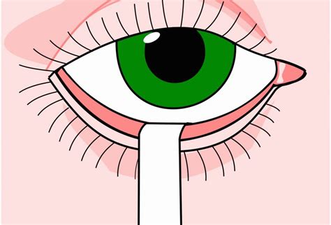 basal tear secretion test|Schirmer's test .